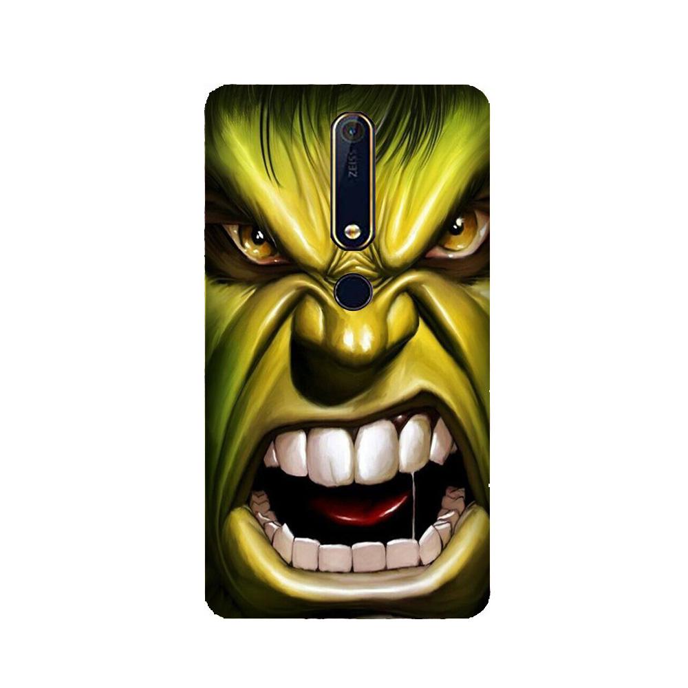 Hulk Superhero Case for Nokia 6.1 (2018)(Design - 121)