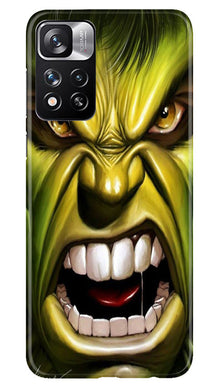 Hulk Superhero Mobile Back Case for Redmi Note 11 Pro  (Design - 121)