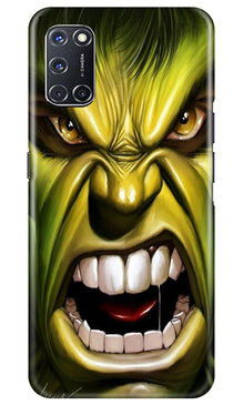 Hulk Superhero Mobile Back Case for Oppo A52  (Design - 121)