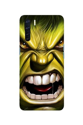 Hulk Superhero Case for Oppo F15  (Design - 121)