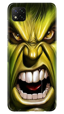 Hulk Superhero Mobile Back Case for Poco C3  (Design - 121)
