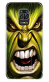 Hulk Superhero Case for Poco M2 Pro  (Design - 121)