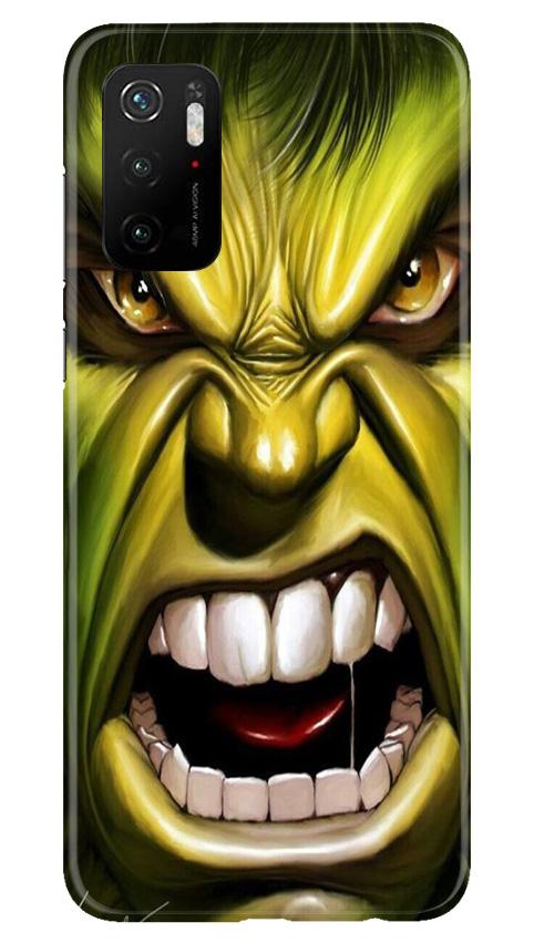 Hulk Superhero Case for Poco M3 Pro  (Design - 121)