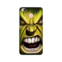 Hulk Superhero Mobile Back Case for Redmi 4  (Design - 121)