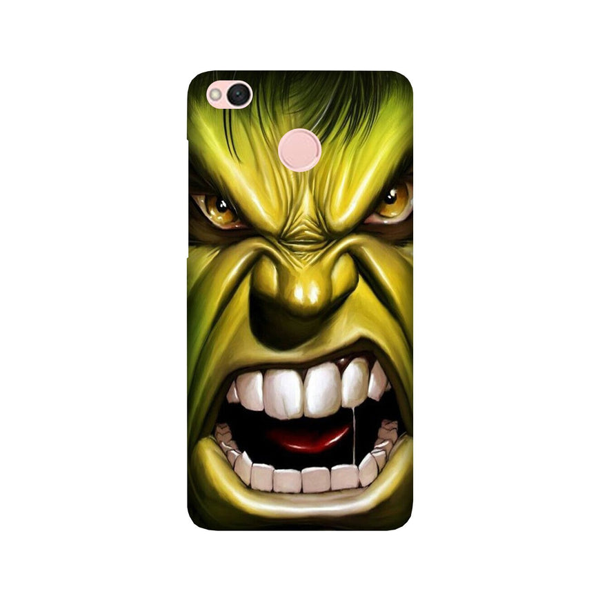 Hulk Superhero Case for Redmi 4  (Design - 121)