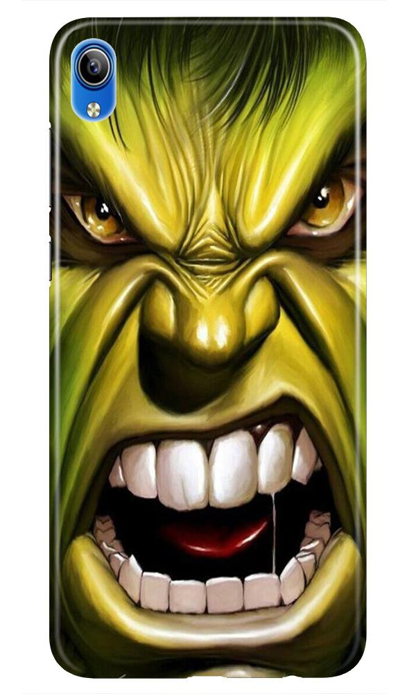 Hulk Superhero Case for Redmi 7a  (Design - 121)