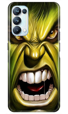 Hulk Superhero Mobile Back Case for Oppo Reno5 Pro  (Design - 121)