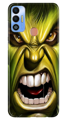 Hulk Superhero Mobile Back Case for Tecno Spark 7T  (Design - 121)