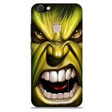 Hulk Superhero Case for Vivo V7  (Design - 121)