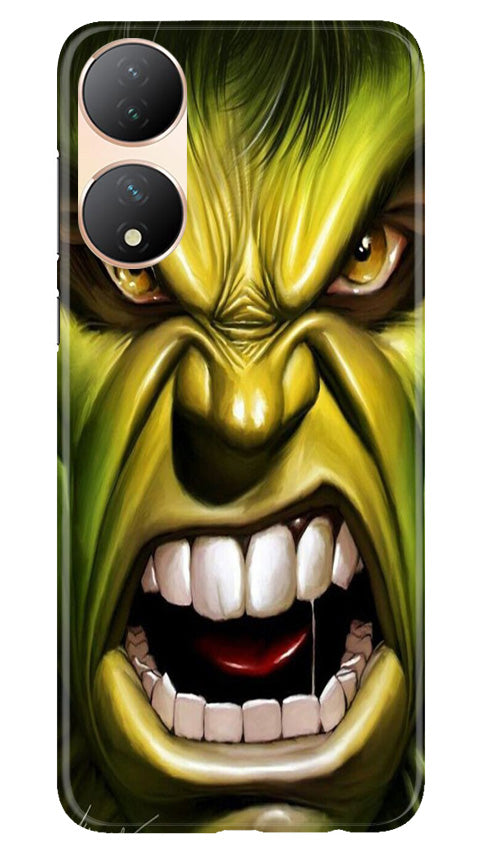 Hulk Superhero Case for Vivo Y100 5G  (Design - 121)