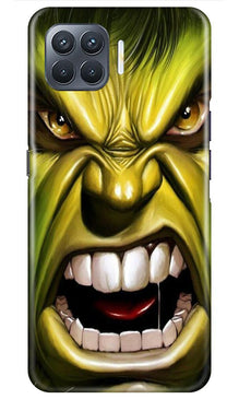 Hulk Superhero Mobile Back Case for Oppo A93  (Design - 121)