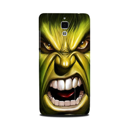Hulk Superhero Case for Mi 4(Design - 121)