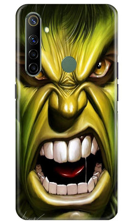 Hulk Superhero Case for Realme Narzo 10(Design - 121)