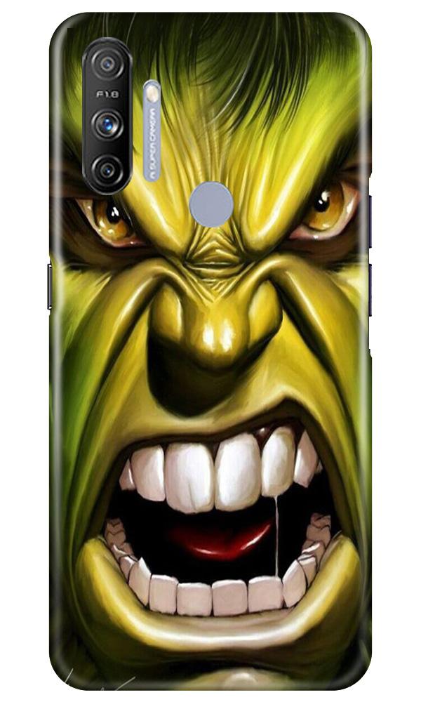 Hulk Superhero Case for Realme Narzo 20A  (Design - 121)