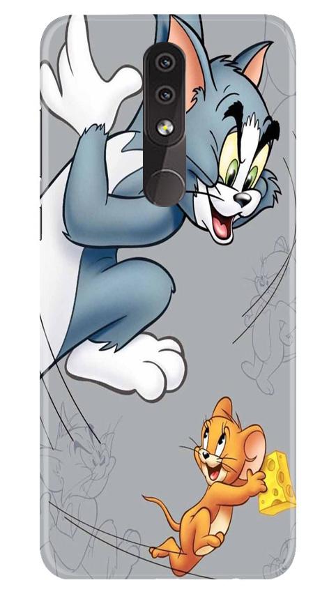 Tom n Jerry Mobile Back Case for Nokia 7.1 (Design - 399)