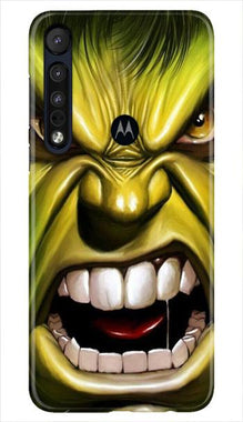 Hulk Superhero Mobile Back Case for Moto One Macro  (Design - 121)