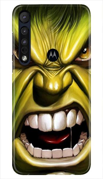 Hulk Superhero Case for Moto One Macro  (Design - 121)