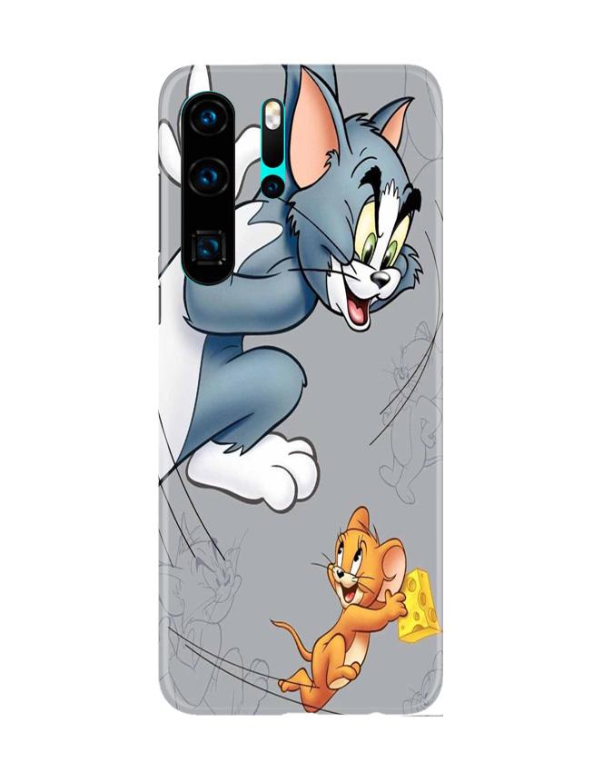 Tom n Jerry Mobile Back Case for Huawei P30 Pro (Design - 399)
