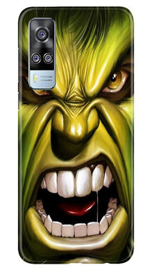Hulk Superhero Mobile Back Case for Vivo Y51A  (Design - 121)