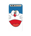 Doremon Mobile Back Case for Infinix Zero 5 (Design - 340)